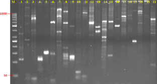 Identification of elite Indian sugarcane varieties through DNA fingerprinting using genic microsatellite markers  