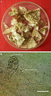 Chytridiomycetes, 
                Obelidium
              , Purified snake skin, Keratinophilic, Chandra Prabha Wildlife Sanctuary