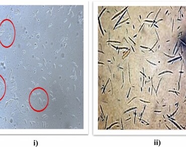 Differential biochemical response of basmati and non-basmati rice seeds upon bakanae (Fusarium fujikuroi) infection 