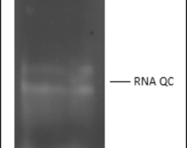 Cloning of laccase gene from Coriolopsis caperata into heterologous E.coli host 