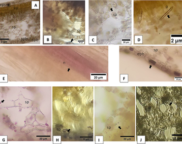 Histochemical, phytochemical, and cytotoxicity of Gyrinops versteegii “Madu” (Thymelaeaceae) against bacteria infectious