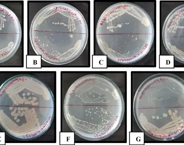 Polyhydroxyalkanoates (PHAs), Biopolymers, Seaweed-associated bacteria, Biodegradation, FT-IR and SEM characterization