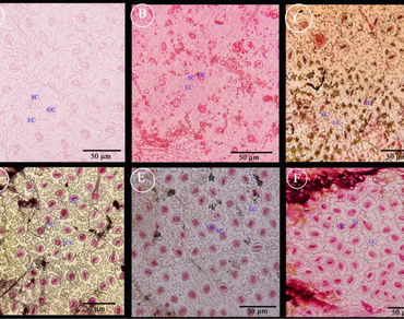 Epidermal structure and its systematic significance of the genus Thunbergia (Family-Acanthaceae) distributed in Assam, India